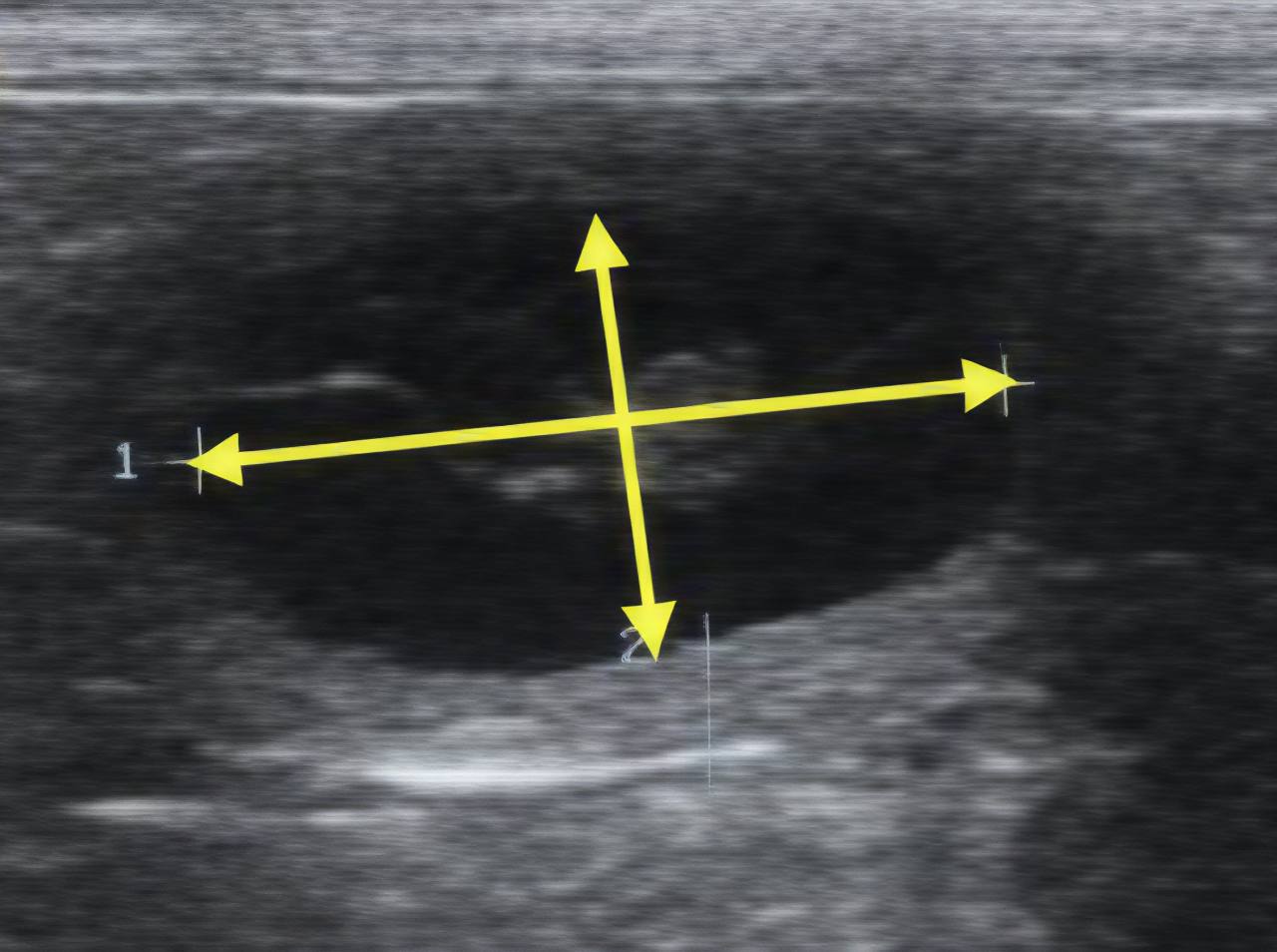 Canine pregnancy ultrasound demonstrating inner chorionic cavity diameter measurement.